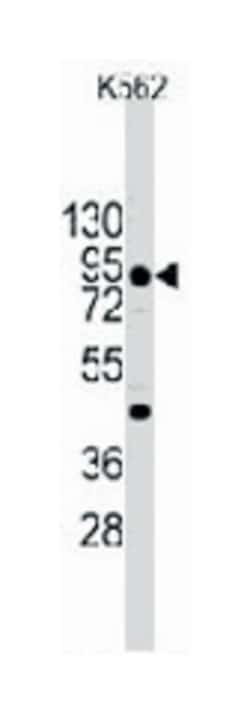 CDH3 Rabbit anti-Human, Polyclonal Antibody, Abnova 400 &mu;L | Buy Online | Abnova Corporation | Fisher Scientific