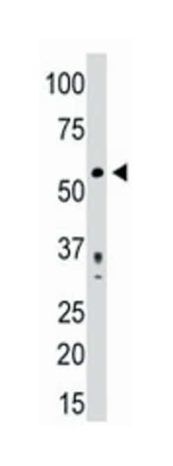 PDHX Rabbit anti-Human, Polyclonal Antibody, Abnova 400 &mu;L | Buy Online | Abnova Corporation | Fisher Scientific