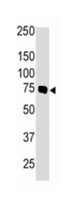 PRKCB Rabbit anti-Human, Monkey, Mouse, Rat, Polyclonal Antibody, Abnova