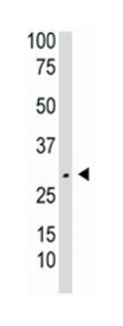 TK2 Rabbit anti-Human, Mouse, Polyclonal Antibody, Abnova 400&mu;L; Unlabeled:Antibodies,