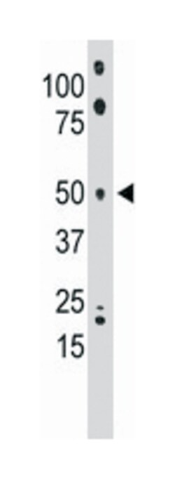 ETNK1 Rabbit anti-Human, Mouse, Polyclonal Antibody, Abnova 400&mu;L; Unlabeled:Antibodies,