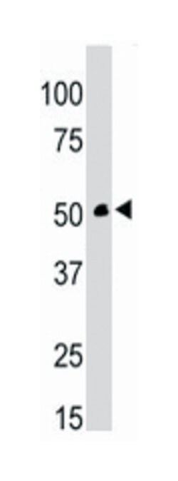 CKMT1A, Rabbit, Polyclonal Antibody, Abnova 400 &mu;L | Buy Online | Abnova Corporation | Fisher Scientific