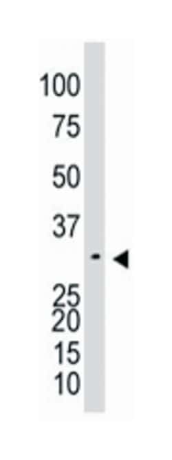 NAGK Rabbit anti-Human, Mouse, Polyclonal Antibody, Abnova 400 &mu;L | Buy Online | Abnova Corporation | Fisher Scientific