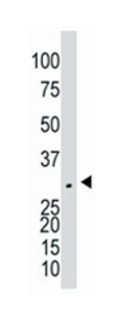 NAGK Rabbit anti-Human, Mouse, Polyclonal Antibody, Abnova 400 &mu;L | Buy Online | Abnova Corporation | Fisher Scientific
