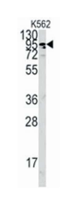 ACE2 Rabbit anti-Human, Polyclonal Antibody, Abnova 400 &mu;L | Buy Online | Abnova Corporation | Fisher Scientific
