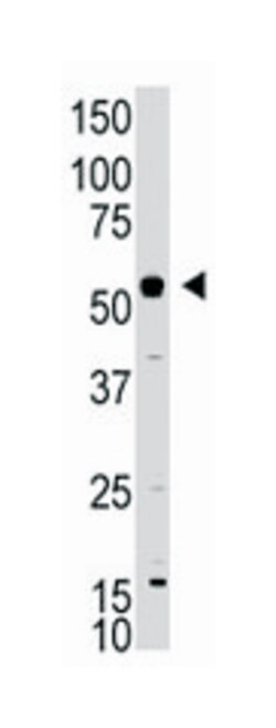 XIAP Rabbit anti-Human, Mouse, Polyclonal Antibody, Abnova 400 &mu;L | Buy Online | Abnova Corporation | Fisher Scientific