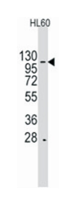 HIRA Rabbit anti-Human, Polyclonal Antibody, Abnova 400 &mu;L | Buy Online | Abnova | Fisher Scientific