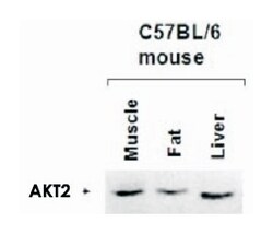 AKT2 Rabbit anti-Human, Mouse, Rat, Polyclonal Antibody, Abnova 100&mu;g;