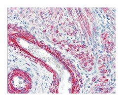 MYL6, Rabbit, Polyclonal Antibody, Abnova 100&mu;g; Unlabeled:Antibodies,