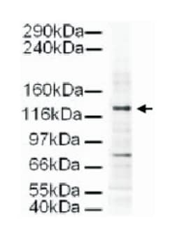 AP3D1, Goat, Polyclonal Antibody, Abnova 100 &mu;g | Buy Online | Abnova Corporation | Fisher Scientific
