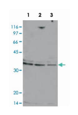 TP53BP2, Rabbit, Polyclonal Antibody, Abnova 100&mu;g; Unlabeled:Antibodies,