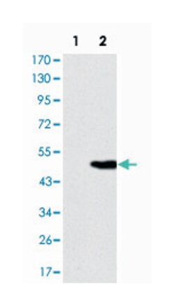 KIF22, Mouse, Clone: 1E3, Abnova 100 &mu;L | Buy Online | Abnova | Fisher Scientific