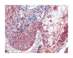 CD44, Rabbit, Clone: SP37, Abnova 100&mu;L; Unlabeled:Antibodies, Monoclonal