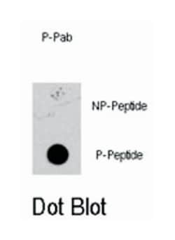 MAP2K1 (phospho S218/S222), Rabbit anti-Human, Polyclonal Antibody, Abnova 400 &mu;L | Buy Online | Abnova Corporation | Fisher Scientific