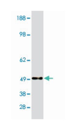 ROBO1 Rabbit anti-Human, Polyclonal Antibody, Abnova 100 &mu;g | Buy Online | Abnova | Fisher Scientific