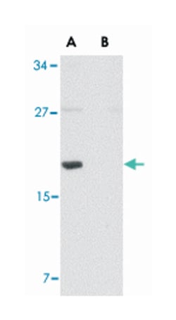 MED28 Rabbit anti-Human, Mouse, Polyclonal Antibody, Abnova 100&mu;g; Unlabeled:Antibodies,
