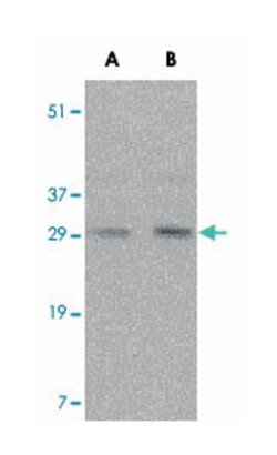 TNFSF11 Rabbit anti-Human, Mouse, Rat, Polyclonal Antibody, Abnova 100 &mu;g | Buy Online | Abnova | Fisher Scientific
