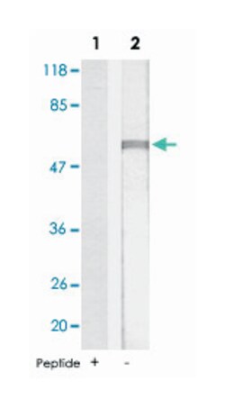 PPP2CB, Rabbit, Polyclonal Antibody, Abnova 100&mu;g; Unlabeled:Antibodies,
