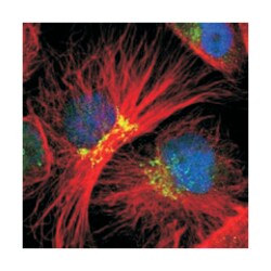 EAPP, Rabbit, Polyclonal Antibody, Abnova 100 &mu;L | Buy Online | Abnova Corporation | Fisher Scientific