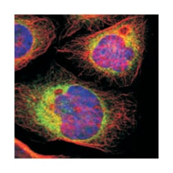 LRPAP1, Rabbit, Polyclonal Antibody, Abnova 100 &mu;L | Buy Online | Abnova Corporation | Fisher Scientific