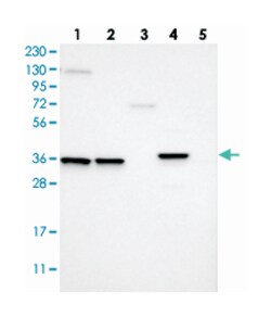 MARC2. Rabbit anti-Human, Polyclonal Antibody, Abnova 100&mu;L; Unlabeled:Anticuerpos