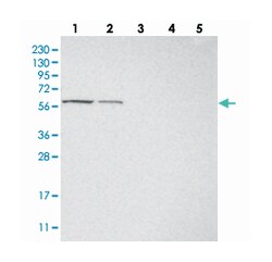 PGBD3, Rabbit, Polyclonal Antibody, Abnova 100 &mu;L | Buy Online | Abnova Corporation | Fisher Scientific