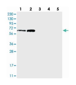TTC24 Rabbit anti-Human, Polyclonal Antibody, Abnova 100&mu;L; Unlabeled:Antibodies,