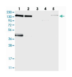 TTBK1 Rabbit anti-Human, Polyclonal Antibody, Abnova 100&mu;L; Unlabeled:Antibodies,