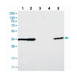 DNAJB14, Rabbit, Polyclonal Antibody, Abnova 100 &mu;L | Buy Online | Abnova Corporation | Fisher Scientific