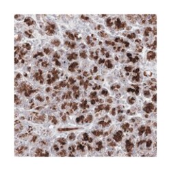 C11orf80, Rabbit, Polyclonal Antibody, Abnova 100&mu;L; Unlabeled:Antibodies,