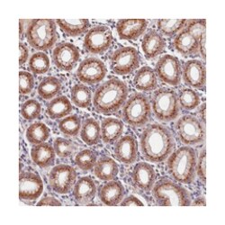 TMEM181, Rabbit, Polyclonal Antibody, Abnova 100 &mu;L | Buy Online | Abnova Corporation | Fisher Scientific