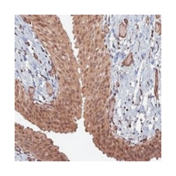 TELO2 Rabbit anti-Human, Polyclonal Antibody, Abnova 100 &mu;L | Buy Online | Abnova Corporation | Fisher Scientific
