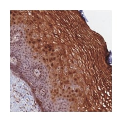 PRELID2, Rabbit, Polyclonal Antibody, Abnova 100&mu;L; Unlabeled:Antibodies,