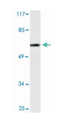 TP53 Rabbit anti-Human, Polyclonal Antibody, Abnova 100 &mu;L | Buy Online | Abnova Corporation | Fisher Scientific