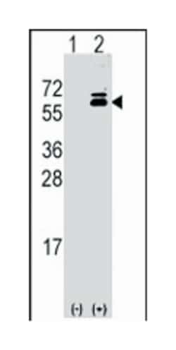 OLFM1 Rabbit anti-Human, Polyclonal Antibody, Abnova 400 &mu;L | Buy Online | Abnova Corporation | Fisher Scientific