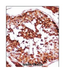 HSFX1, Rabbit, Polyclonal Antibody, Abnova 400 &mu;L | Buy Online | Abnova Corporation | Fisher Scientific