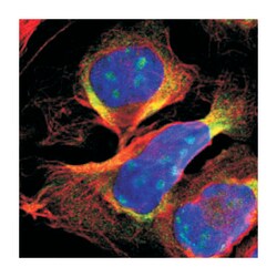 DDX24, Rabbit, Polyclonal Antibody, Abnova 100&mu;L; Unlabeled:Antibodies,