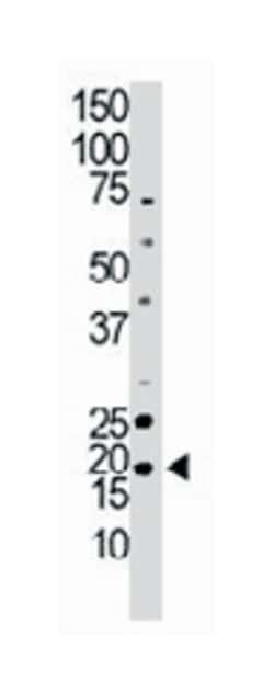 NME6, Rabbit, Polyclonal Antibody, Abnova 400 &mu;L | Buy Online | Abnova | Fisher Scientific