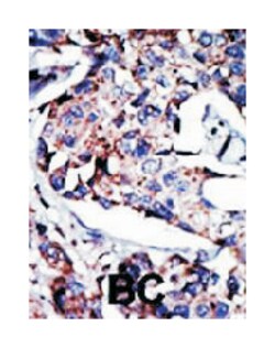DGKD Rabbit anti-Human, Mouse, Polyclonal Antibody, Abnova 400&mu;L; Unlabeled:Antibodies,