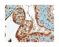 CD274, Goat, Polyclonal Antibody, Abnova 100 &mu;g | Buy Online | Abnova Corporation | Fisher Scientific
