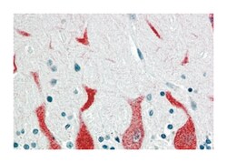 RARA, Goat, Polyclonal Antibody, Abnova 100 &mu;g | Buy Online | Abnova Corporation | Fisher Scientific