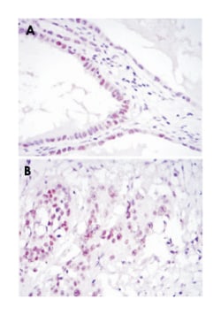 SUZ12, Mouse, Clone: 3D10, Abnova 100&mu;L; Unlabeled:Anticuerpos