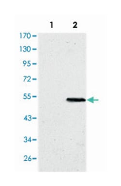 SUZ12, Mouse, Clone: 3D10, Abnova 100&mu;L; Unlabeled:Anticuerpos