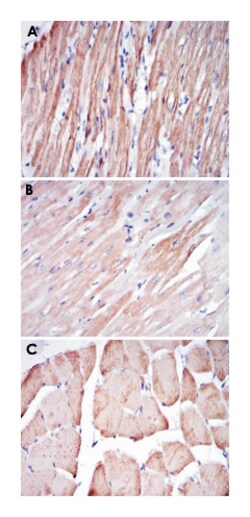 TNNI2, Mouse, Clone: 2F12A11, Abnova 100&mu;L; Unlabeled:Antibodies, Monoclonal