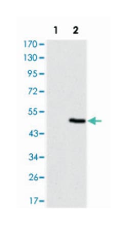 TNNI2, Mouse, Clone: 2F12A11, Abnova 100&mu;L; Unlabeled:Antibodies, Monoclonal