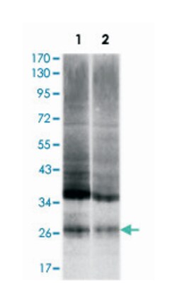 UBB, Mouse, Clone: 3C12, Abnova 100&mu;L; Unlabeled:Antibodies, Monoclonal