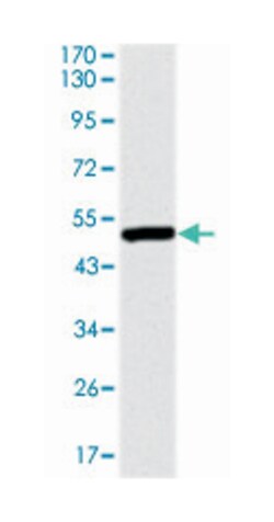 UBB, Mouse, Clone: 3C12, Abnova 100&mu;L; Unlabeled:Antibodies, Monoclonal