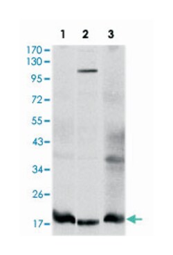 UBE2I, Mouse, Clone: 1B10, Abnova 100&mu;L; Unlabeled:Antibodies, Monoclonal