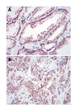 UBE2I, Mouse, Clone: 1B10, Abnova 100&mu;L; Unlabeled:Antibodies, Monoclonal
