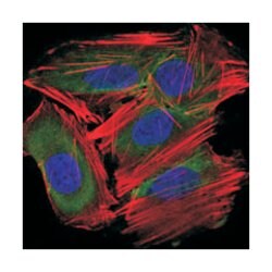 UBE2I, Mouse, Clone: 1B10, Abnova 100&mu;L; Unlabeled:Antibodies, Monoclonal